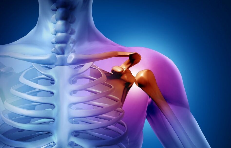 нараняване на раменната става поради артроза