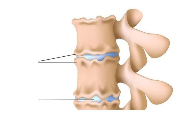 нараняване на гръбначния стълб